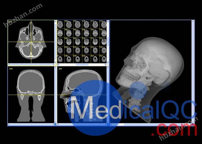 CIRS 711-HN头部模体