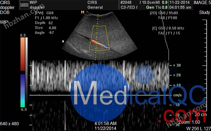 Cirs 069A多普勒模体